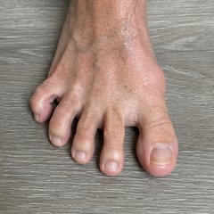 Separación activa de dedos (toe splay) — ejercicio de pie