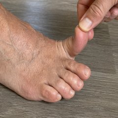Movilidad del hallux (dedo gordo) — ejercicio de pie